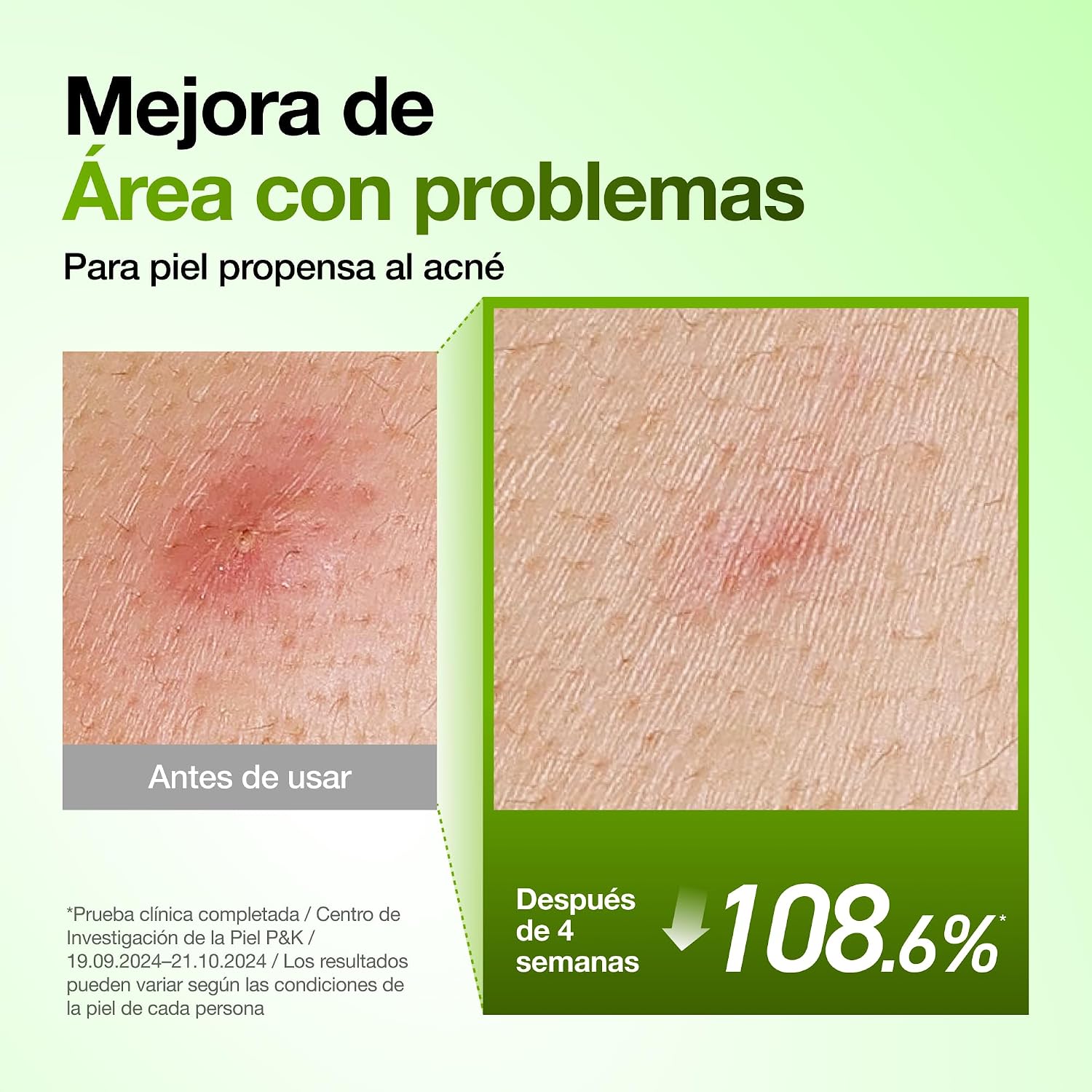 ANUA 10+ AZELAIC ACID 10 + HYALURON SERUM 30ML