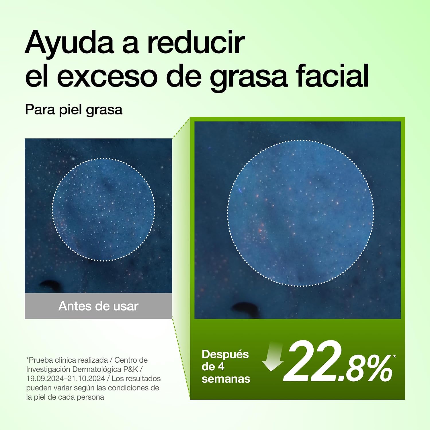 ANUA 10+ AZELAIC ACID 10 + HYALURON SERUM 30ML